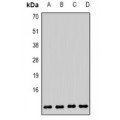 LifeSab™ COX6B1 Rabbit pAb (50 µl)