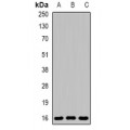 LifeSab™ EVA1A Rabbit pAb (50 µl)