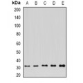 LifeSab™ FGFBP1 Rabbit pAb (50 µl)