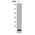 LifeSab™ TF2A2 Rabbit pAb (50 µl)