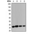LifeSab™ TIM3 Rabbit pAb (50 µl)