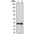 LifeSab™ HJV Rabbit pAb (50 µl)