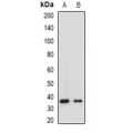 LifeSab™ HLA-DRA Rabbit pAb (50 µl)