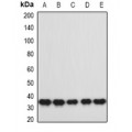 LifeSab™ HNRNPA0 Rabbit pAb (50 µl)