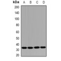 LifeSab™ HUS1B Rabbit pAb (50 µl)