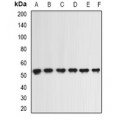 LifeSab™ ING1 Rabbit pAb (50 µl)