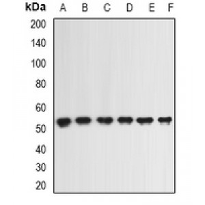 LifeSab™ ING1 Rabbit pAb (50 µl)