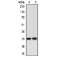 LifeSab™ ING5 Rabbit pAb (50 µl)
