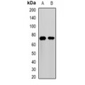 LifeSab™ MMP25 Rabbit pAb (50 µl)