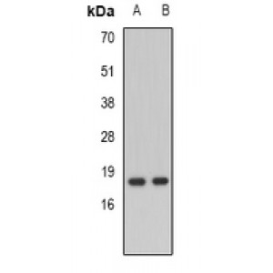 LifeSab™ NDP Rabbit pAb (50 µl)