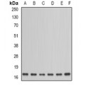 LifeSab™ NDUFA12 Rabbit pAb (50 µl)