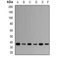LifeSab™ NKX2-5 Rabbit pAb (50 µl)