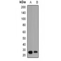 LifeSab™ PLGF Rabbit pAb (50 µl)