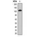 LifeSab™ PHC3 Rabbit pAb (50 µl)