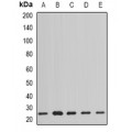 LifeSab™ PPP3R2 Rabbit pAb (50 µl)