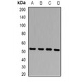 LifeSab™ PSEN2 Rabbit pAb (50 µl)
