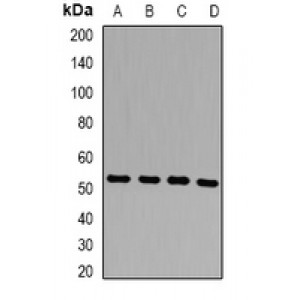 LifeSab™ PSEN2 Rabbit pAb (50 µl)