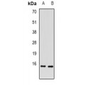 LifeSab™ RBP2 Rabbit pAb (50 µl)