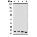 LifeSab™ RBP4 Rabbit pAb (50 µl)