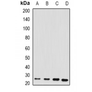 LifeSab™ RBP4 Rabbit pAb (50 µl)