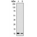 LifeSab™ RHEB Rabbit pAb (50 µl)
