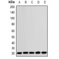 LifeSab™ RNF5 Rabbit pAb (50 µl)