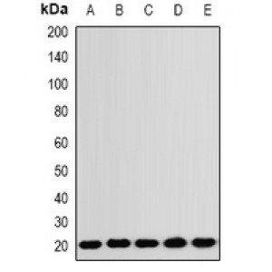 LifeSab™ RNF5 Rabbit pAb (50 µl)