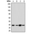 LifeSab™ SH3GL2 Rabbit pAb (50 µl)