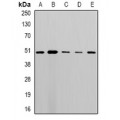 LifeSab™ MLN64 Rabbit pAb (50 µl)