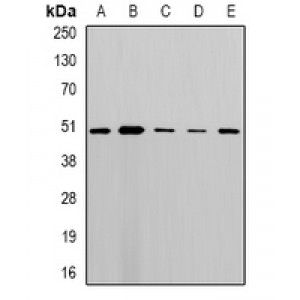 LifeSab™ MLN64 Rabbit pAb (50 µl)