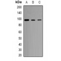 LifeSab™ CD281 Rabbit pAb (50 µl)