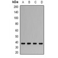 LifeSab™ CLN2 Rabbit pAb (50 µl)