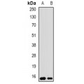 LifeSab™ UBCH5 Rabbit pAb (50 µl)