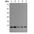 LifeSab™ UBE2D4 Rabbit pAb (50 µl)