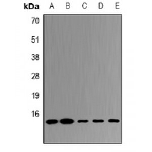 LifeSab™ UBE2D4 Rabbit pAb (50 µl)