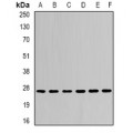 LifeSab™ CDC34B Rabbit pAb (50 µl)