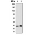 LifeSab™ WNT7B Rabbit pAb (50 µl)