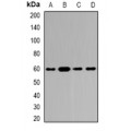 LifeSab™ YARS1 Rabbit pAb (50 µl)