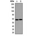 LifeSab™ CYP1A2 Rabbit pAb (50 µl)