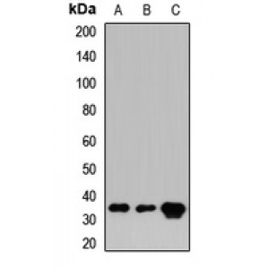 LifeSab™ CRKL Rabbit pAb (50 µl)