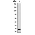LifeSab™ SMNDC1 Rabbit pAb (50 µl)