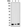 LifeSab™ RAP1A Rabbit pAb (50 µl)