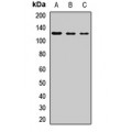 LifeSab™ PIK3CB Rabbit pAb (50 µl)