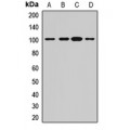LifeSab™ ADAM22 Rabbit pAb (50 µl)