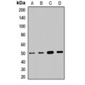 LifeSab™ SUCLA2 Rabbit pAb (50 µl)