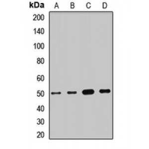 LifeSab™ SUCLA2 Rabbit pAb (50 µl)