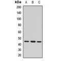 LifeSab™ CHRNE Rabbit pAb (50 µl)