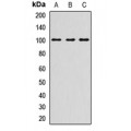 LifeSab™ DSC1 Rabbit pAb (50 µl)