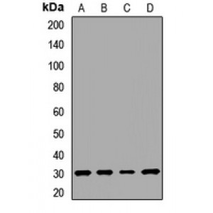 LifeSab™ SCN1B Rabbit pAb (50 µl)