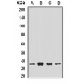 LifeSab™ NACA1 Rabbit pAb (50 µl)